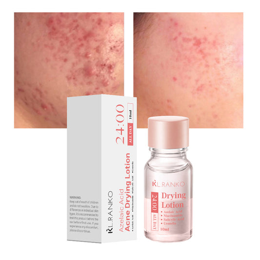 Salicylic Acid Facial Serum