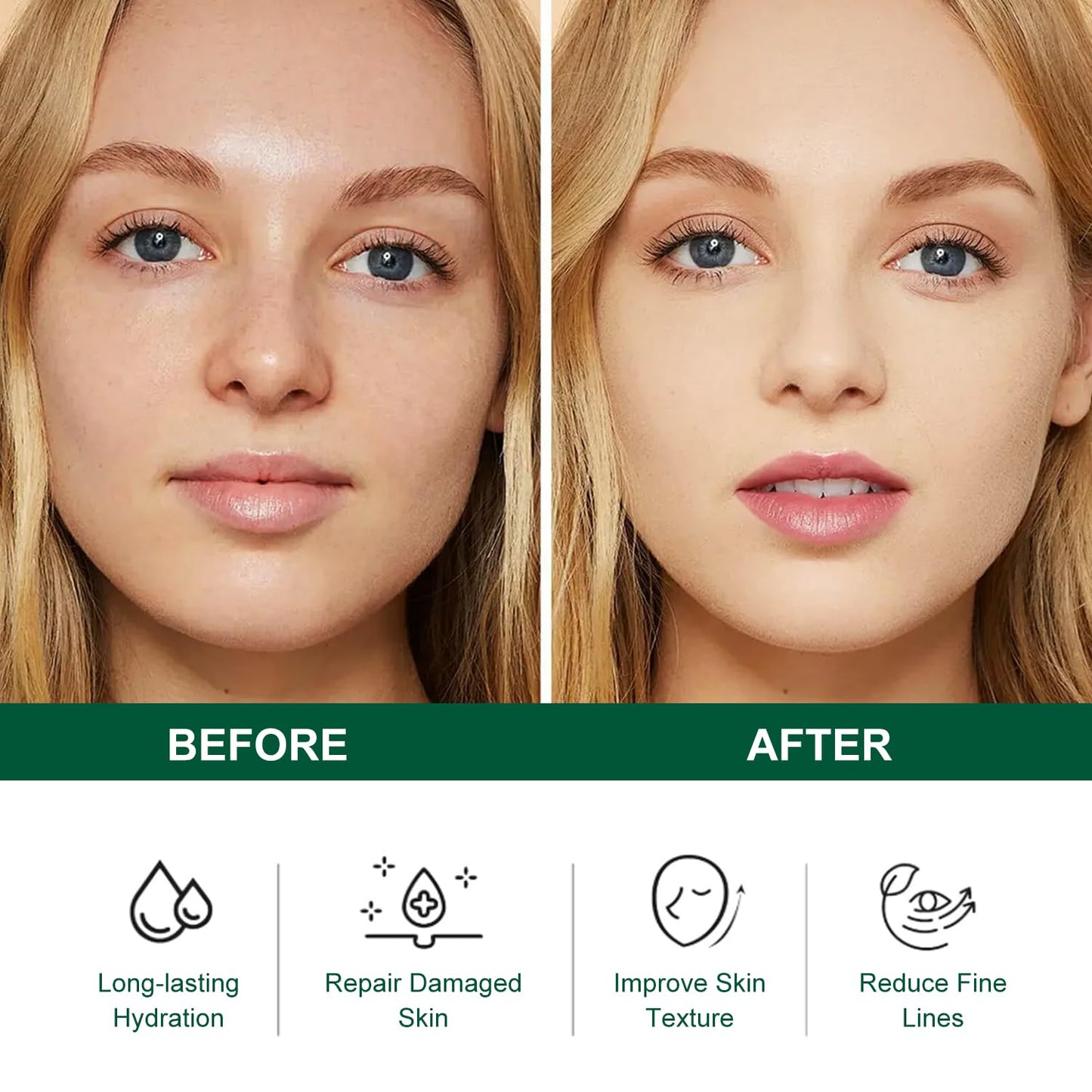 Tea Tree Salicylic Acid Acne Treatment Skincare Set - Mini Facial Care Kit for Women, Includes Cleanser, Toner, Serum, and Cream, Ideal for Oil Control and Travel