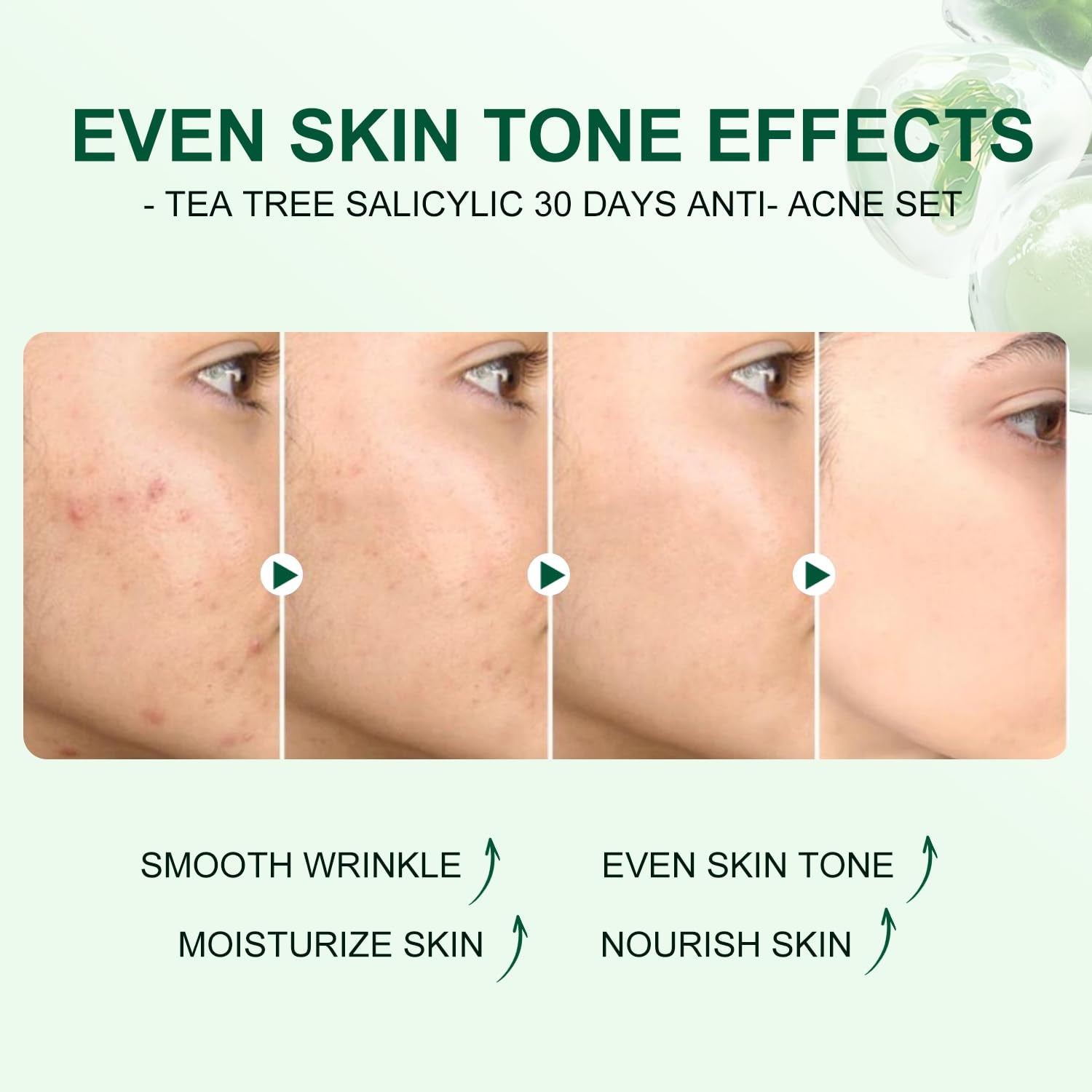 Tea Tree Salicylic Acid Acne Treatment Skincare Set - Mini Facial Care Kit for Women, Includes Cleanser, Toner, Serum, and Cream, Ideal for Oil Control and Travel