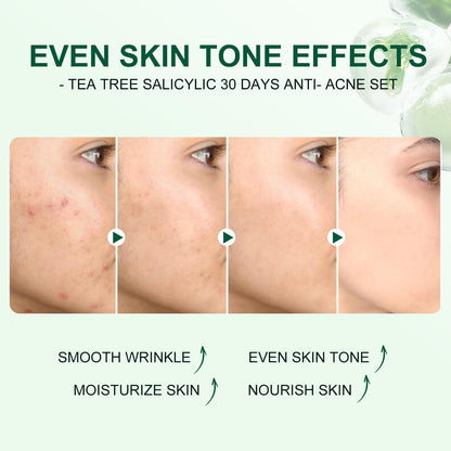 Tea Tree Salicylic Acid Acne Treatment Skincare Set - Mini Facial Care Kit for Women, Includes Cleanser, Toner, Serum, and Cream, Ideal for Oil Control and Travel